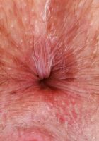 Adora Bell Lingerie Hairy Pussy Spreads, Adora Bell (ado005) ATK Natural & Hairy: Adora Bell (Adora Bell Lingerie Hairy Pussy Spreads)