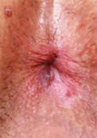 Amber showing a lot of her trimmed pussy, Amber Summer (amb070) ATK Galleria: Amber Summer (Amber showing a lot of her trimmed pussy)