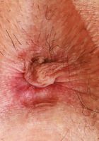 Amber Summer Pussy Gaping, Amber Summer (amb070) ATK Natural & Hairy: Amber Summer (Amber Summer Pussy Gaping)