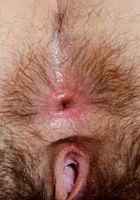 Anika Darling in scary hairy, Anika Darling (ani053) ATK Natural & Hairy: Anika Darling (Anika Darling in scary hairy)