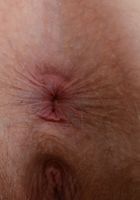 Apricot Pitts in young and hairy, Apricot Pitts (apr024) ATK Natural & Hairy: Apricot Pitts (Apricot Pitts in young and hairy)