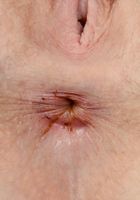 Apricot Pitts in young and hairy, Apricot Pitts (apr024) ATK Natural & Hairy: Apricot Pitts (Apricot Pitts in young and hairy)