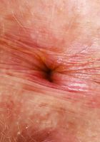 Apricot Pitts Yellow Set & Spreading, Apricot Pitts (apr024) ATK Natural & Hairy: Apricot Pitts (Apricot Pitts Yellow Set & Spreading)