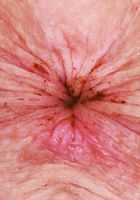 Apricot Pitts Sexy Hairy Spreading, Apricot Pitts (apr024) ATK Natural & Hairy: Apricot Pitts (Apricot Pitts Sexy Hairy Spreading)