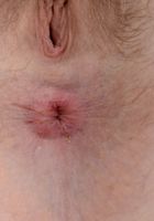 Apricot Pitts in young and hairy, Apricot Pitts (apr024) ATK Natural & Hairy: Apricot Pitts (Apricot Pitts in young and hairy)