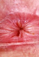 Apricot Pitts is a real hit with fans, Apricot Pitts (apr024) ATK Natural & Hairy: Apricot Pitts (Apricot Pitts is a real hit with fans)