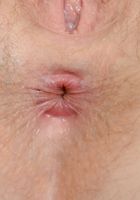 Apricot Pitts in young and hairy, Apricot Pitts (apr024) ATK Natural & Hairy: Apricot Pitts (Apricot Pitts in young and hairy)