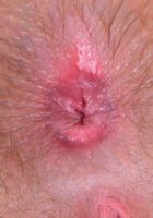Aali spreads her pink hairy holes open., Aali Rousseau (aul001) ATK Natural & Hairy: Aali Rousseau (Aali spreads her pink hairy holes open.)