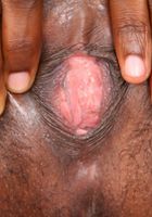 Black model Babydoll spreads her pussy, Babydoll (bab008) ATK Petites: Babydoll (Black model Babydoll spreads her pussy)