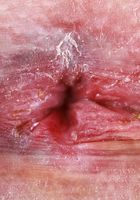 Beverly Hillson's pussy is on full display, Beverly Hillson (bev003) ATK Galleria: Beverly Hillson (Beverly Hillson's pussy is on full display)
