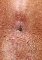 Binky Beaz Spreads her Holes, Binky Beaz (bin002) ATK Exotics: Binky Beaz (Binky Beaz Spreads her Holes)