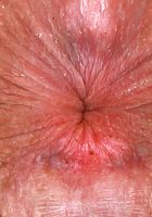 Cece Lachey Spreading Outdoors her Hairy Holes, Cece Lachey (cec015) ATK Natural & Hairy: Cece Lachey (Cece Lachey Spreading Outdoors her Hairy Holes)