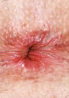 Chloe Foster Hot Stripping, Chloe Foster (chl033) ATK Natural & Hairy: Chloe Foster (Chloe Foster Hot Stripping)