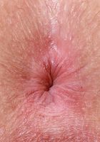 Dixie Lynn in amateur, Dixie Lynn (dix006) ATK Galleria: Dixie Lynn (Dixie Lynn in amateur)