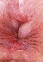 Dria Submits shows off her impressive vagina, Dria Submits (dri003) ATK Natural & Hairy: Dria Submits (Dria Submits shows off her impressive vagina)