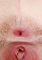 Emma squats down for a nice set of hairy pussy spreads., Emma Evins (emm030) ATK Natural & Hairy: Emma Evins (Emma squats down for a nice set of hairy pussy spreads.)