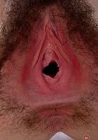 Emma spreads her hairy pussy to gape., Emma Evins (emm030) ATK Natural & Hairy: Emma Evins (Emma spreads her hairy pussy to gape.)