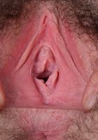 Emma has a beautiful pussy, with a ring of fur around it., Emma Evins (emm030) ATK Natural & Hairy: Emma Evins (Emma has a beautiful pussy, with a ring of fur around it.)