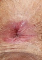 Felicia Fisher in young and hairy, Felicia Fisher (fel024) ATK Natural & Hairy: Felicia Fisher (Felicia Fisher in young and hairy)