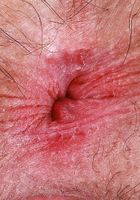 Gigi wants your opinion on her pussy gape, Gigi (gig009) ATK Natural & Hairy: Gigi (Gigi wants your opinion on her pussy gape)