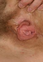 Ginger Nipples from ATK Archives