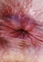 Hazel Paige Outdoor Nudity, Hazel Paige (haz017) ATK Galleria: Hazel Paige (Hazel Paige Outdoor Nudity)