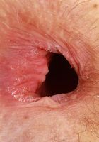 Jackie Hoff Huge Asshole Gaping, Jackie Hoff (jac041) ATK Petites: Jackie Hoff (Jackie Hoff Huge Asshole Gaping)