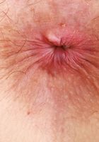 Jackie Hoff Gaping Asshole, Jackie Hoff (jac041) ATK Natural & Hairy: Jackie Hoff (Jackie Hoff Gaping Asshole)