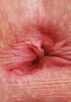 Kallie Taylor Strips & Spreads Wide, Kallie Taylor (kal019) ATK Premium: Kallie Taylor (Kallie Taylor Strips & Spreads Wide)