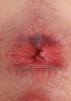 Kate Bloom Strips All Of her Clothes Off, Kate Bloom (kat245) ATK Galleria: Kate Bloom (Kate Bloom Strips All Of her Clothes Off)