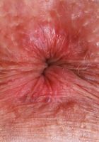Kiley Corrupt Lingerie Mature Pussy Spreading, Kiley Corrupt (kil002) ATK Galleria: Kiley Corrupt (Kiley Corrupt Lingerie Mature Pussy Spreading)