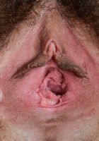 Wara in scary hairy, Wara (kir015) ATK Natural & Hairy: Wara (Wara in scary hairy)