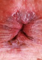 Leda Lotharia Pink Pussy Tight Ass Spreading, Leda Lotharia (led002) ATK Galleria: Leda Lotharia (Leda Lotharia Pink Pussy Tight Ass Spreading)