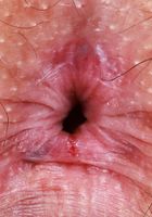 Leena Spreads and Gapes, Lenna (lee019) ATK Natural & Hairy: Lenna (Leena Spreads and Gapes)