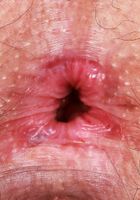 Curvy hairy Lenna shows it all., Lenna (lee019) ATK Natural & Hairy: Lenna (Curvy hairy Lenna shows it all.)