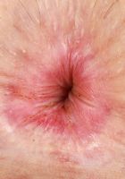 Minxx Marley Upskirt Spreads, Minxx Marley (min020) ATK Petites: Minxx Marley (Minxx Marley Upskirt Spreads)
