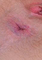 Nickey spreads and gapes for you pleasure., Nickey Huntsman (nic093) ATK Natural & Hairy: Nickey Huntsman (Nickey spreads and gapes for you pleasure.)