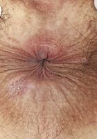 Iris Ivy in exotic and hairy, Iris Ivy (pap001) ATK Petites: Iris Ivy (Iris Ivy in exotic and hairy)