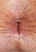 Penelope Reed Hole Spreads, Penelope Reed (pen027) ATK Petites: Penelope Reed (Penelope Reed Hole Spreads)
