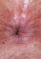 Penelope Woods Spreads her Holes, Penelope Woods (pen030) ATK Exotics: Penelope Woods (Penelope Woods Spreads her Holes)