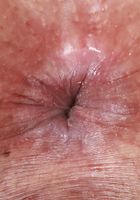 Penelope Woods Open Wide, Penelope Woods (pen030) ATK Exotics: Penelope Woods (Penelope Woods Open Wide)