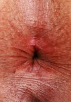 Penelope Woods Nude Upskirt, Penelope Woods (pen030) ATK Exotics: Penelope Woods (Penelope Woods Nude Upskirt)