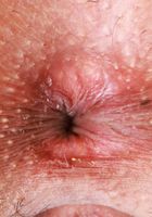 Reina Heart Spreads Her Tight Holes, Reina Heart (rei001) ATK Petites: Reina Heart (Reina Heart Spreads Her Tight Holes)
