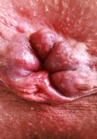 Riley Jean spreads her legs and plays with her labia, Riley Jean (ril020) ATK Natural & Hairy: Riley Jean (Riley Jean spreads her legs and plays with her labia)