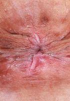 Sona takes it all off a little at a time., Sona Bella (son031) ATK Petites: Sona Bella (Sona takes it all off a little at a time.)