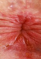 Stephanie Gwen Outdoor Nudity, Stephanie Gwen (ste079) ATK Petites: Stephanie Gwen (Stephanie Gwen Outdoor Nudity)