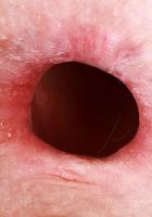 Storm Rose Gapes Both Holes, Storm Rose (sto007) ATK Galleria: Storm Rose (Storm Rose Gapes Both Holes)