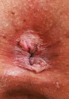 Summer Col Outside Latina Pussy and Ass, Summer Col (sum028) ATK Petites: Summer Col (Summer Col Outside Latina Pussy and Ass)