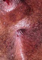 Black model Tahyti spreads her hole, Tahyti (tah006) ATK Exotics: Tahyti (Black model Tahyti spreads her hole)