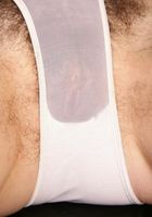 Urtica in scary hairy, Urtica (urt001) ATK Natural & Hairy: Urtica (Urtica in scary hairy)